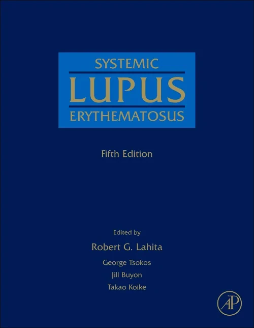 Systemic Lupus Erythematosus