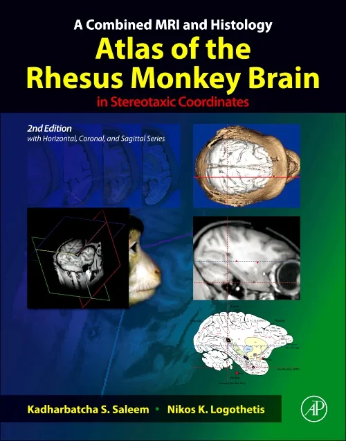 A Combined MRI and Histology Atlas of the Rhesus M...