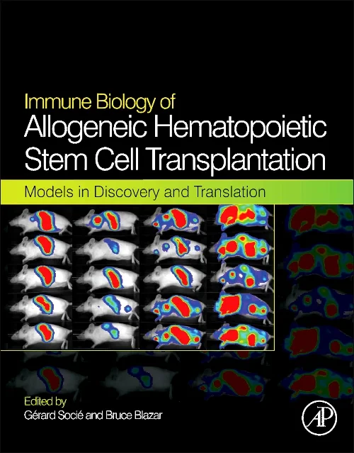 Immune Biology of Allogeneic Hematopoietic Stem Ce...