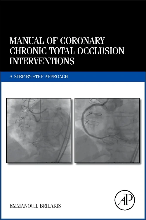 Manual of Coronary Chronic Total Occlusion Interve...