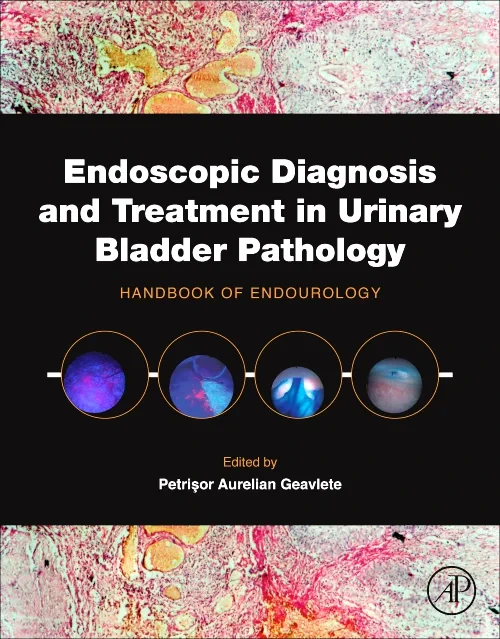 Endoscopic Diagnosis and Treatment in Urinary Blad...