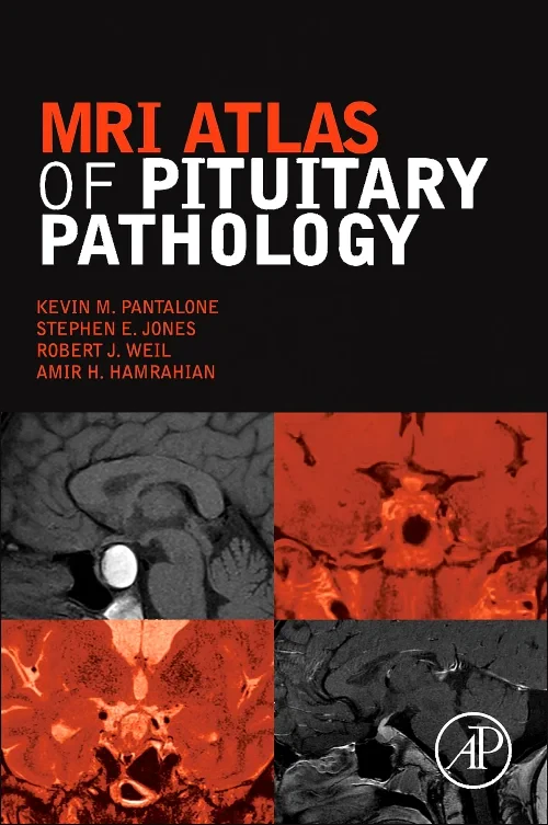 MRI Atlas of Pituitary Pathology