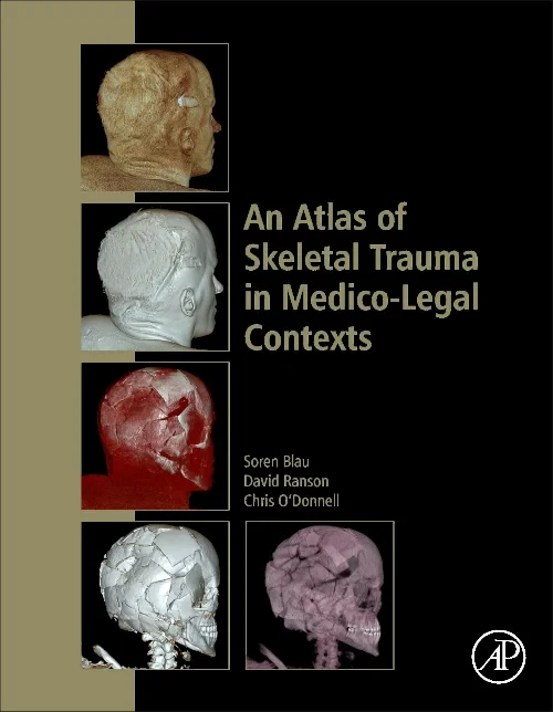 An Atlas of Skeletal Trauma in Medico-Legal Contex...
