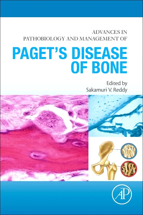 Advances in Pathobiology and Management of Paget’s...