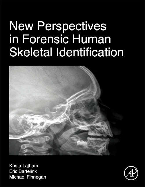 New Perspectives in Forensic Human Skeletal Identi...