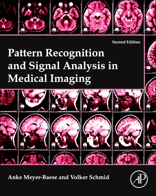 Pattern Recognition and Signal Analysis in Medical...