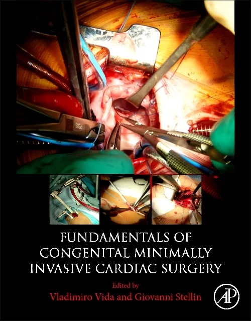 Fundamentals of Congenital Minimally Invasive Card...