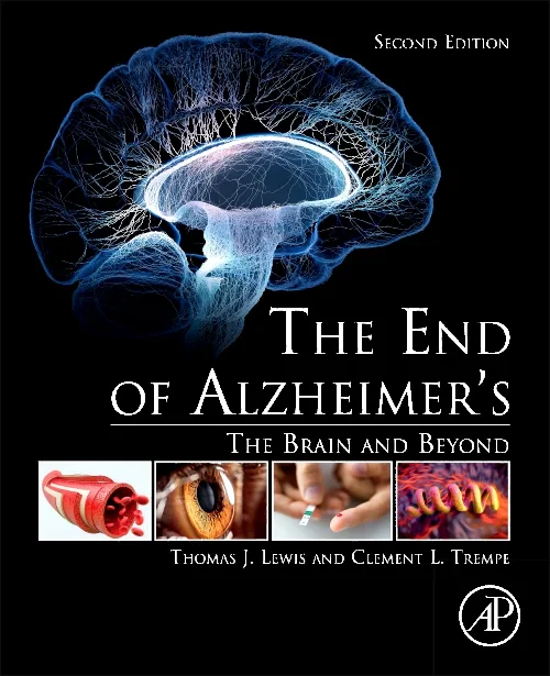 The End of Alzheimer’s