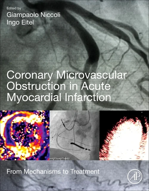 Coperta cărții "Coronary Microvascular Obstruction in Acute Myocardial Infarction: From Mechanisms to Treatment" de autor necunoscut