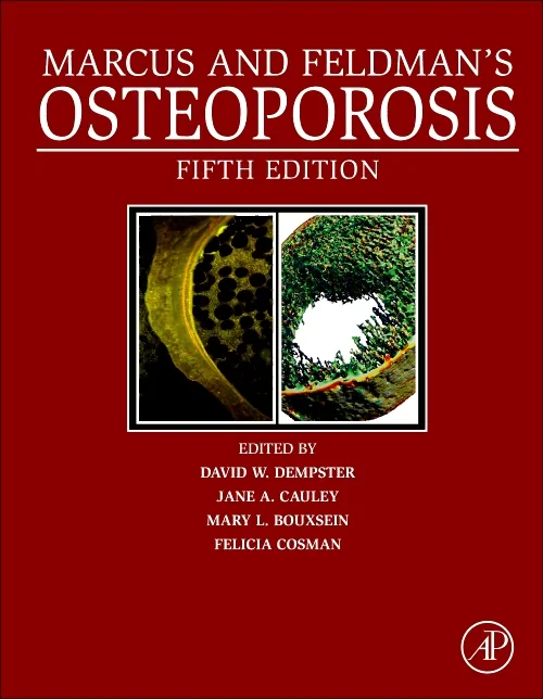 Coperta cărții "Osteoporosis, 4th Edition" de autor necunoscut