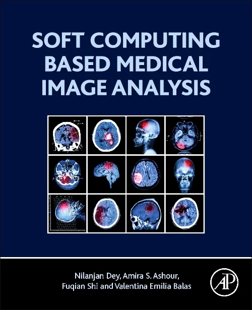 Soft Computing Based Medical Image Analysis