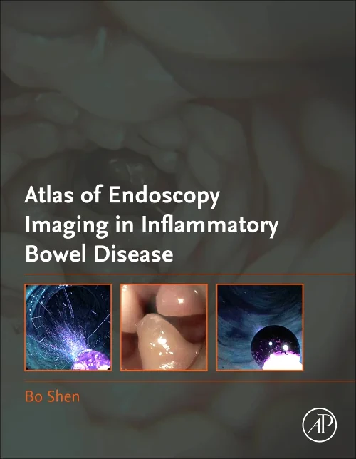 Atlas of Endoscopy Imaging in Inflammatory Bowel D...