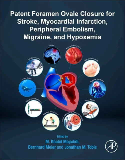 Patent Foramen Ovale Closure for Stroke, Myocardia...