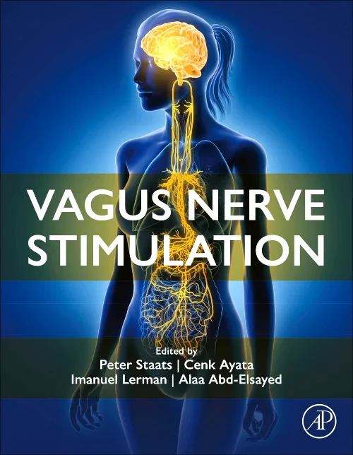 Vagus Nerve Stimulation