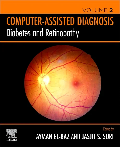 Diabetes and Retinopathy