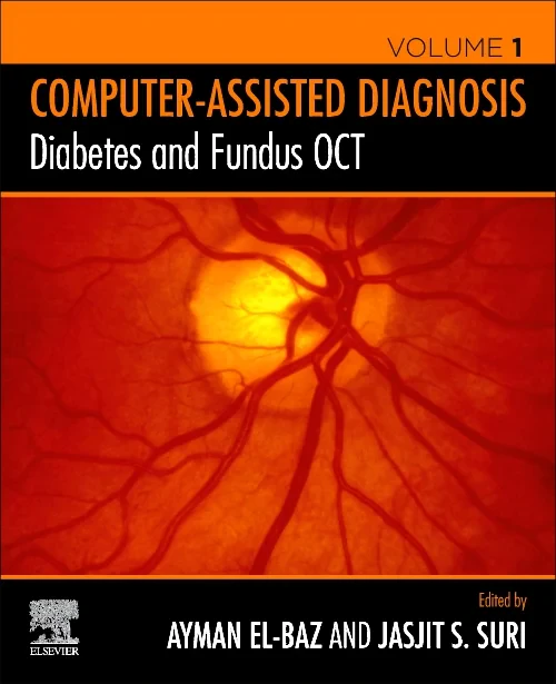 Diabetes and Fundus OCT