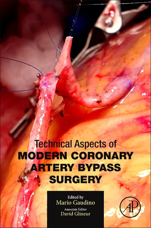 Technical Aspects of Modern Coronary Artery Bypass...
