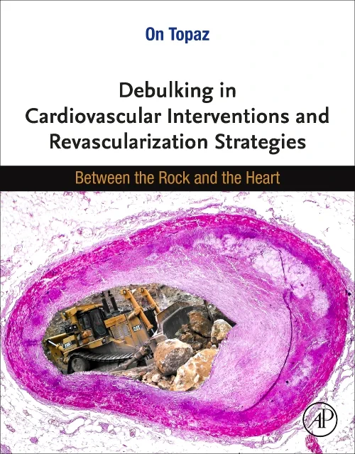 Debulking in Cardiovascular Interventions and Reva...