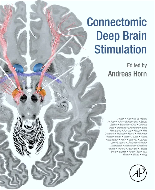 Connectomic Deep Brain Stimulation