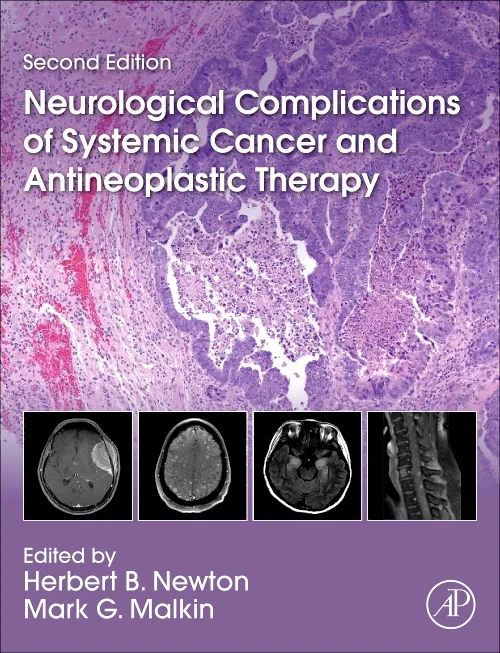 Neurological Complications of Systemic Cancer and ...