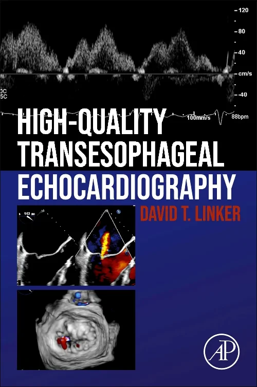 High-Quality Transesophageal Echocardiography