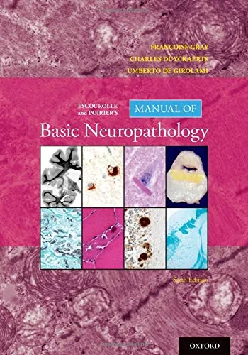 Coperta cărții "Escourolle and Poirier&amp;#146;s Manual of Basic Neuropathology" de autor necunoscut