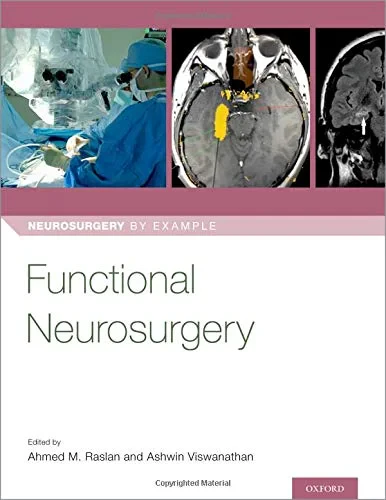 Coperta cărții "Functional Neurosurgery (Neurosurgery by Example)" de autor necunoscut