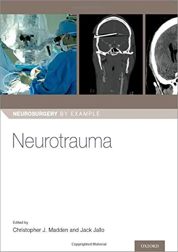 Coperta cărții &quot;Neurotrauma (Neurosurgery by Example)&quot; de autor necunoscut