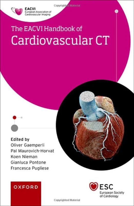 Coperta cărții "EACVI Handbook of Cardiovascular CT" de autor necunoscut