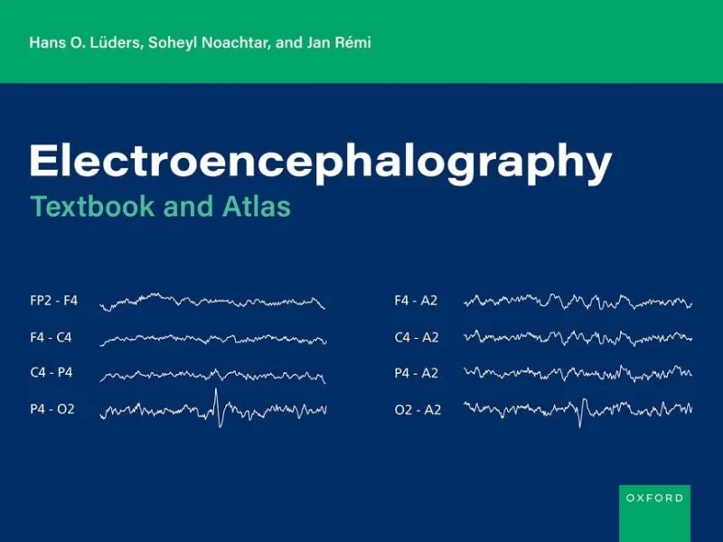 Coperta cărții "Electroencephalography: Textbook and Atlas" de autor necunoscut