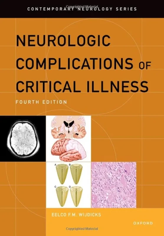 Coperta cărții "Neurologic Complications of Critical Illness" de autor necunoscut