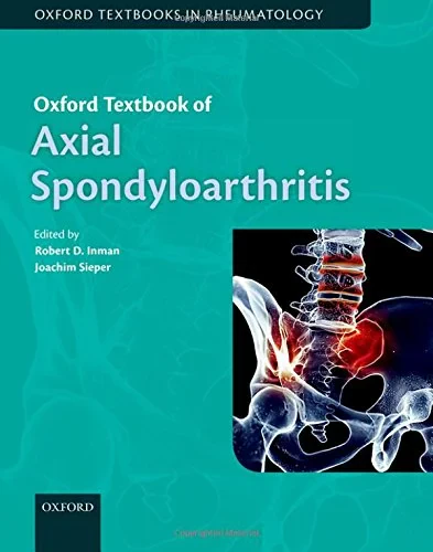 Coperta cărții "Oxford Textbook of Axial Spondyloarthritis" de autor necunoscut