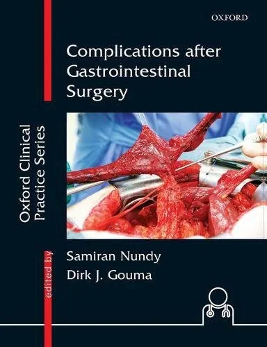 Coperta cărții "Complications after Gastrointestinal Surgery" de autor necunoscut