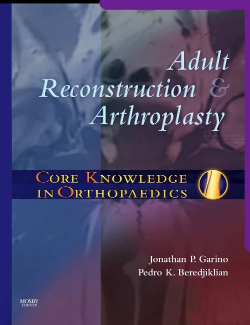 Core Knowledge in Orthopaedics: Adult Reconstructi...