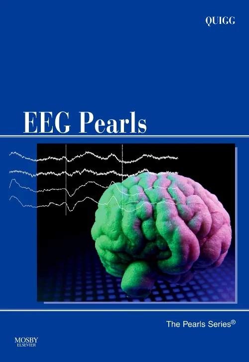 Coperta cărții "EEG Pearls" de autor necunoscut