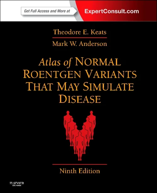 Atlas of Normal Roentgen Variants That May Simulat...
