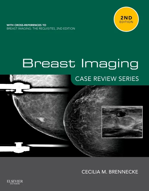 Breast Imaging: Case Review Series