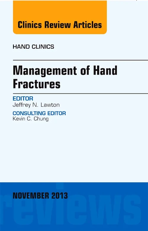 Management of Hand Fractures, An Issue of Hand Cli...