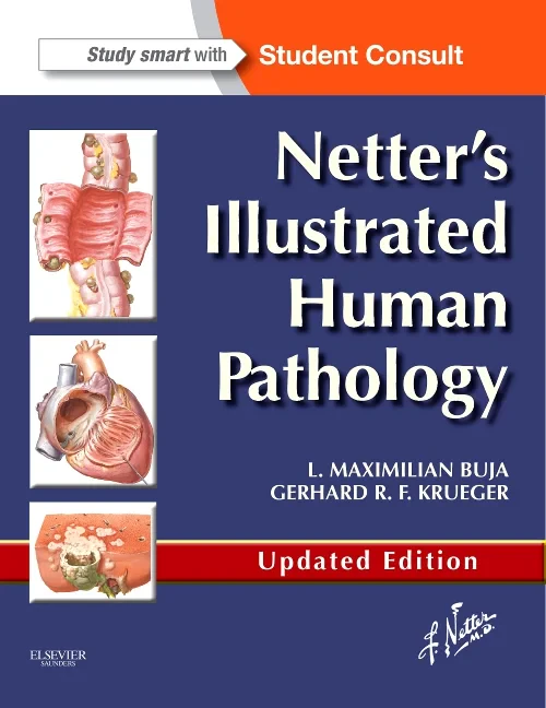 Netter's Illustrated Human Pathology Updated Editi...