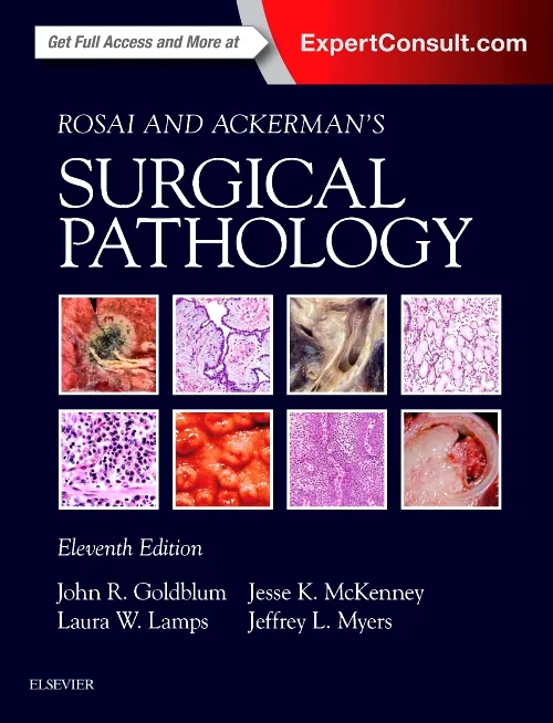 Coperta cărții "Rosai and Ackerman&amp;#146;s Surgical Pathology - 2 Volume Set" de autor necunoscut