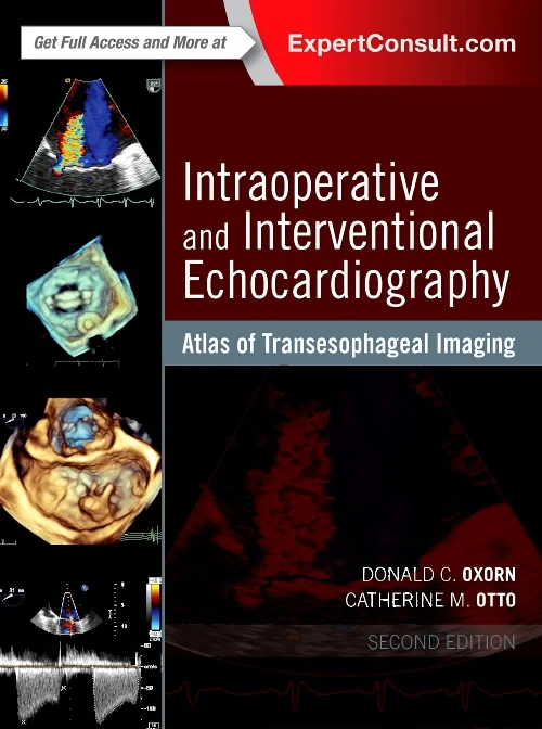 Coperta cărții "Intraoperative and Interventional Echocardiography: Atlas of Transesophageal Imaging, 2e" de autor necunoscut