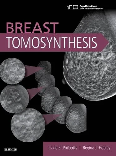Coperta cărții "Breast Tomosynthesis" de autor necunoscut