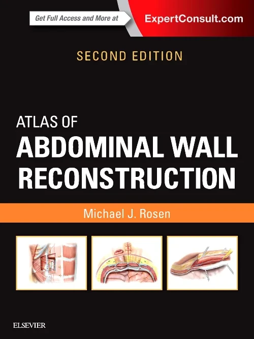 Atlas of Abdominal Wall Reconstruction