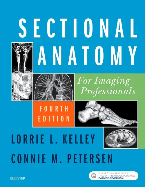 Coperta cărții "Sectional Anatomy for Imaging Professionals" de autor necunoscut