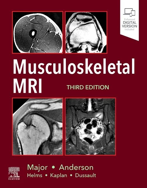 Coperta cărții "Musculoskeletal MRI, 3rd Edition" de autor necunoscut