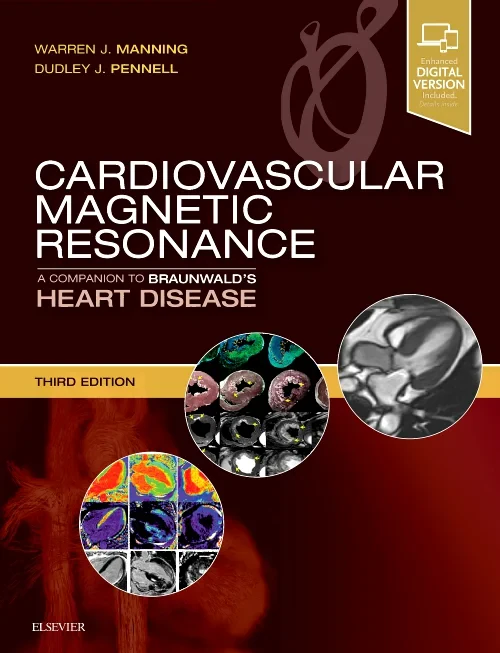 Coperta cărții "Cardiovascular Magnetic Resonance: A Companion to Braunwald&amp;#146;s Heart Disease, 3e" de autor necunoscut