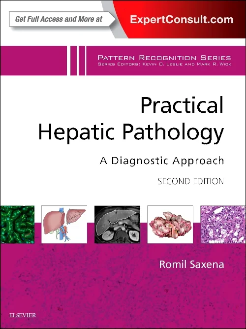 Coperta cărții "Practical Hepatic Pathology: A Diagnostic Approach: A Volume in the Pattern Recognition Series" de autor necunoscut