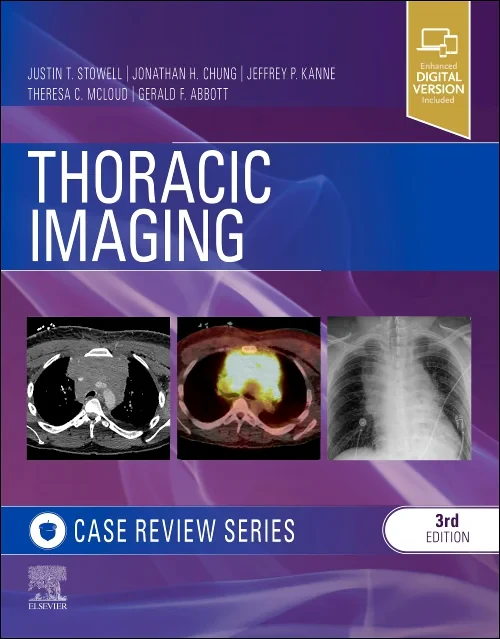 Coperta cărții "Thoracic Imaging: Case Review" de autor necunoscut