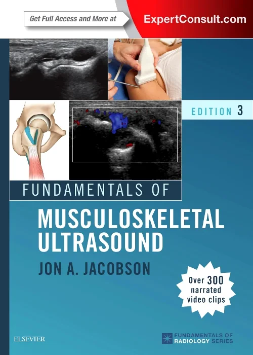 Coperta cărții "Fundamentals of Musculoskeletal Ultrasound, 3e (Fundamentals of Radiology)" de autor necunoscut