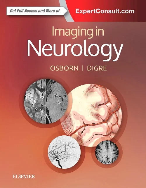 Coperta cărții "Imaging in Neurology" de autor necunoscut